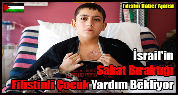 Israil'in Sakat Biraktigi Filistinli Cocuk Yardim Bekliyor