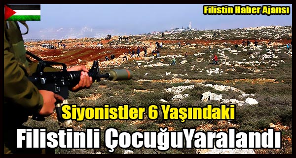 Siyonistler 6 Yasindaki Filistinli CocuguYaralandi