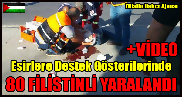 Esirlere Destek Gosterilerinde 80 FILISTINLI YARALANDI +VIDEO