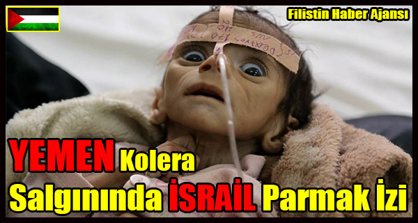 YEMEN Kolera Salgininda ISRAIL Parmak Izi